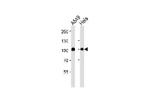 Western blot analysis of lysates from A549,Hela cell line (from left to right),using Uba2 Antibody (ABIN484072 and ABIN1533453). (UBA2 抗体)