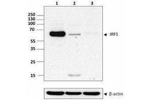 Western Blotting (WB) image for anti-Interferon Regulatory Factor 5 (IRF5) antibody (ABIN2666392) (IRF5 抗体)