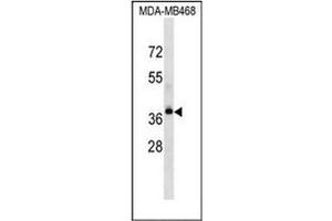 Western blot analysis of P2RY9 / LPAR4 Antibody (Center) in MDA-MB468 cell line lysates (35ug/lane). (LPAR4 抗体  (Middle Region))