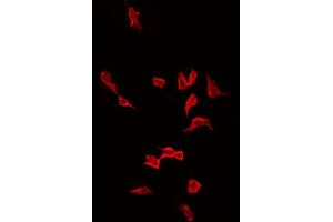 ABIN6268879 staining LOVO by IF/ICC. (Actin 抗体  (N-Term))
