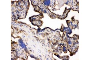 IHC analysis of TFRC using anti-TFRC antibody (ABIN3043538). (Transferrin Receptor 抗体  (AA 1-198))