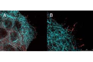Immunofluorescence (IF) image for anti-V-Akt Murine Thymoma Viral Oncogene Homolog 1 (AKT1) (Ser473) antibody (ABIN400784) (AKT1 抗体  (Ser473))