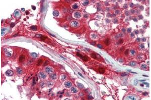 Human Testis (formalin-fixed, paraffin-embedded) stained with GATA3 antibody ABIN462169 followed by biotinylated goat anti-rabbit IgG secondary antibody ABIN481713, alkaline phosphatase-streptavidin and chromogen. (GATA3 抗体  (AA 36-85))