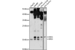 Western blot analysis of extracts of various cell lines, using EREG antibody (ABIN7266994) at 1:1000 dilution. (Epiregulin 抗体  (C-Term))