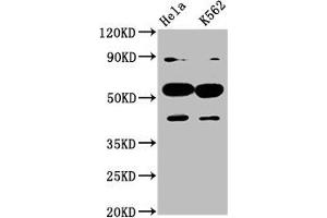 Western Blot Positive WB detected in: Hela whole cell lysate, K562 whole cell lysate All lanes: CYP7A1 antibody at 4. (CYP7A1 抗体  (AA 303-423))