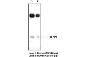 Image no. 1 for anti-Prostaglandin D2 Synthase (PTGDS) antibody (ABIN2451689)