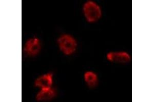 Immunofluorescence (fixed cells) (IF/ICC) image for anti-Zinc Finger CCCH-Type Containing 8 (ZC3H8) (Internal Region) antibody (ABIN6258445)