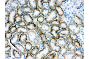 Immunohistochemistry (IHC) image for anti-Solute Carrier Family 22 (Organic Cation Transporter), Member 2 (SLC22A2) (AA 524-555), (Middle Region) antibody (ABIN3043926)