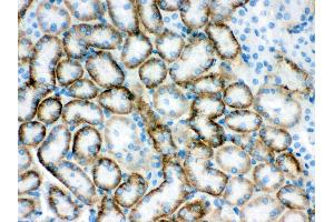 Anti- SLC22A2 Picoband antibody, IHC(P) IHC(P): Mouse Kidney Tissue (SLC22A2 抗体  (Middle Region))