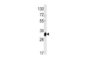 Western blot analysis of ELOVL6 antibody (N-term) (ABIN390425 and ABIN2840812) in mouse liver tissue lysates (35 μg/lane). (ELOVL6 抗体  (N-Term))