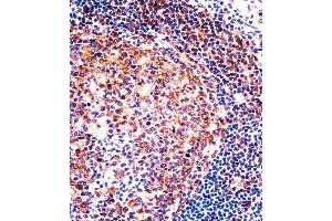 Immunohistochemistry (IHC) image for anti-Prostaglandin I2 (Prostacyclin) Synthase (PTGIS) (AA 210-238) antibody (ABIN5536968)