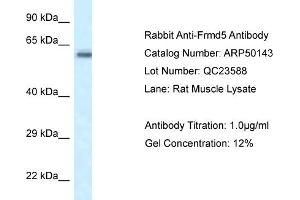 WB Suggested Anti-Frmd5 Antibody   Titration: 1. (FRMD5 抗体  (N-Term))