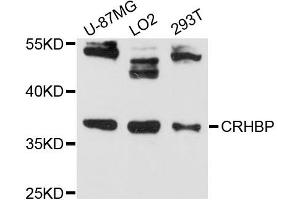 Western blot analysis of extracts of various cell lines, using CRHBP antibody (ABIN6291541) at 1:3000 dilution. (CRHBP 抗体)
