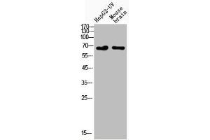 Western Blot analysis of HepG2-UVmouse brain cells using Acetyl-NFκB-p65 (K122) Polyclonal Antibody (NF-kB p65 抗体  (acLys122))