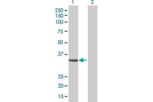 Western Blot analysis of ADAMTS4 expression in transfected 293T cell line by ADAMTS4 MaxPab polyclonal antibody.