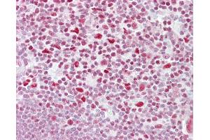 Anti-NFATC3 antibody IHC of human thymus. (NFATC3 抗体  (AA 324-373))