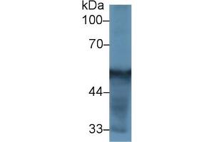 Detection of CYP2D6 in Rat Liver lysate using Polyclonal Antibody to Cytochrome P450 2D6 (CYP2D6) (CYP2D6 抗体  (AA 236-472))