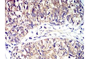 Immunohistochemistry (IHC) image for anti-Chemokine (C-C Motif) Receptor 5 (CCR5) antibody (ABIN5611203)