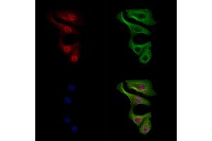 Phospho-MKK3/MKK6 (Thr193/Thr211) Antibody staining Hela cells(heat shock treatment) by IF/ICC.