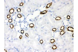 Immunohistochemistry (IHC) image for anti-Solute Carrier Family 12 (Sodium/potassium/chloride Transporters), Member 1 (SLC12A1) (AA 52-83), (N-Term) antibody (ABIN3043925)