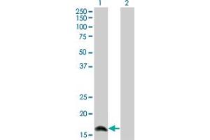 Western Blot analysis of IFNA2 expression in transfected 293T cell line by IFNA2 monoclonal antibody (M36), clone 2C10. (IFNA2 抗体  (AA 24-188))