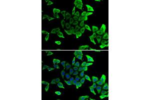 Immunofluorescence analysis of U2OS cells using SGCD antibody. (SGCD 抗体)