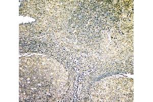 IHC analysis of ARA9/AIP using anti-ARA9/AIP antibody (ABIN6719423).