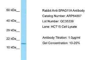 Western Blotting (WB) image for anti-Sperm Associated Antigen 11A (SPAG11A) (N-Term) antibody (ABIN971765) (SPAG11A 抗体  (N-Term))