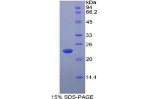 SDS-PAGE analysis of Rat Interferon alpha 5 Protein. (IFNA5 蛋白)