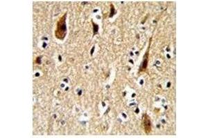 IHC analysis of FFPE human brain with APP antibody (APP 抗体  (AA 29-61))