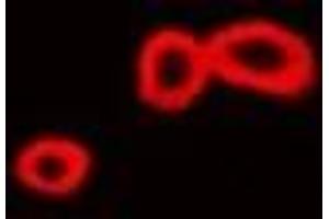Immunofluorescent analysis of ST3GAL4 staining in Hela cells. (ST3GAL4 抗体)