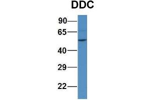 WB Suggested Anti-DDC Antibody Titration:  1ug/ml  Positive Control:  Human 293T cell lysate (DDC 抗体  (N-Term))
