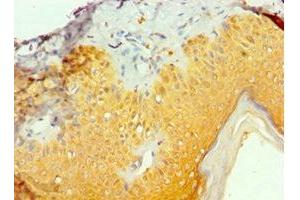 Immunohistochemistry of paraffin-embedded human skin tissue using ABIN7161993 at dilution of 1: 100