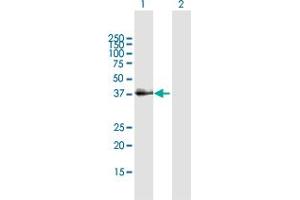 Western Blot analysis of SFTPD expression in transfected 293T cell line by SFTPD MaxPab polyclonal antibody. (SFTPD 抗体  (AA 1-375))