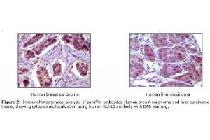 Image no. 1 for anti-B-Cell CLL/lymphoma 10 (BCL10) antibody (ABIN207592) (BCL10 抗体)