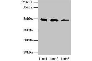 Western blot All lanes: ZBTB6 antibody at 8 μg/mL Lane 1: Hela whole cell lysate Lane 2: HepG2 whole cell lysate Lane 3: 293T whole cell lysate Secondary Goat polyclonal to rabbit IgG at 1/10000 dilution Predicted band size: 49 kDa Observed band size: 49 kDa (ZBTB6 抗体  (AA 115-424))