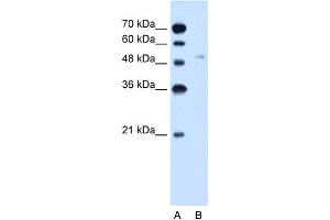 WB Suggested Anti-SLC2A6 Antibody Titration:  2. (SLC2A6 抗体  (C-Term))