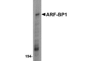 Western Blotting (WB) image for anti-HECT, UBA and WWE Domain Containing 1, E3 Ubiquitin Protein Ligase (HUWE1) (C-Term) antibody (ABIN1030253) (HUWE1 抗体  (C-Term))