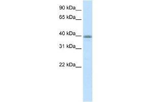 Transfected 293T; WB Suggested Anti-NEUROD6 Antibody Titration: 0. (NEUROD6 抗体  (N-Term))