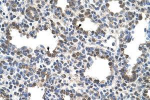 Image no. 1 for anti-Butyrylcholinesterase (BCHE) (AA 151-200) antibody (ABIN205033) (Butyrylcholinesterase 抗体  (AA 151-200))