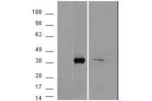 Image no. 2 for anti-Aldo-Keto Reductase Family 1, Member B10 (Aldose Reductase) (AKR1B10) (C-Term) antibody (ABIN374920) (AKR1B10 抗体  (C-Term))