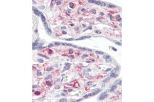 Immunohistochemical analysis of formalin-fixed and paraffin-embedded human Placenta tissue reacted with IRAK Antibody (C-term), which was peroxidase-conjugated to the secondary antibody, followed by AEC staining. (IRAK1 抗体)