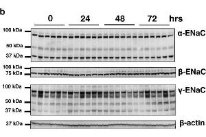The expression of ENaC subunits after preservation in UW solution. (SCNN1A 抗体  (AA 617-638))