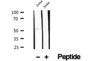 Western blot analysis of extracts of Jurkat cells, using GSDMD antibody. (GSDMD 抗体)