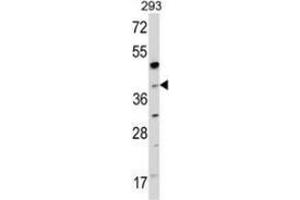 Western blot analysis of NAGK (arrow) in 293 cell line lysates (35ug/lane) using NAGK  Antibody (C-term). (NAGK 抗体  (C-Term))