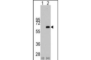 Western blot analysis of MYC (arrow) using rabbit polyclonal MYC Antibody  (ABIN388720 and ABIN2838829).