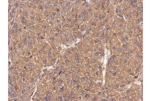 IHC-P Image Immunohistochemical analysis of paraffin-embedded U87 xenograft, using FMNL1, antibody at 1:500 dilution. (Formin-Like 1 抗体)