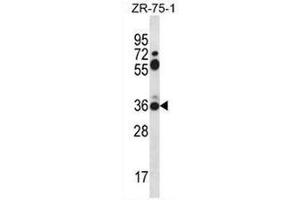 Western blot analysis in ZR-75-1 cell line lysates (35µg/lane) using Syntaxin 2 / STX2 Antibody (Center) Cat. (STX2 抗体  (Middle Region))