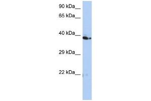 C10ORF46 antibody used at 1 ug/ml to detect target protein. (CACUL1 抗体  (Middle Region))