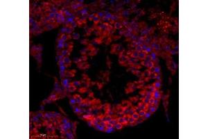 Immunofluorescence (Paraffin-embedded Sections) (IF (p)) image for anti-Coiled-Coil Domain Containing 147 (CCDC147) antibody (ABIN7073535)